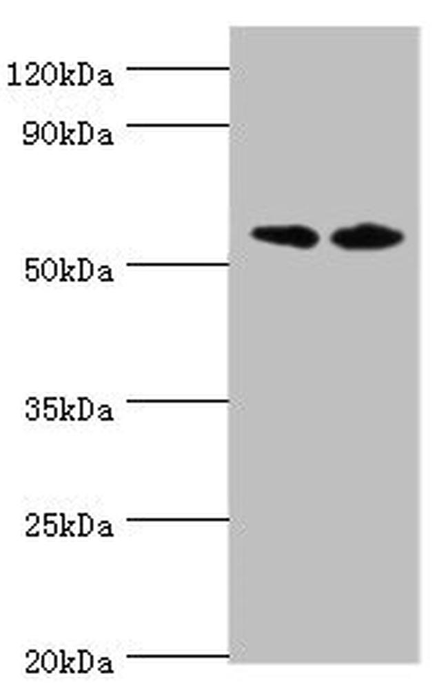 Placental Alkaline Phosphatase Antibody in Western Blot (WB)