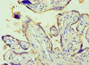 Placental Alkaline Phosphatase Antibody in Immunohistochemistry (Paraffin) (IHC (P))