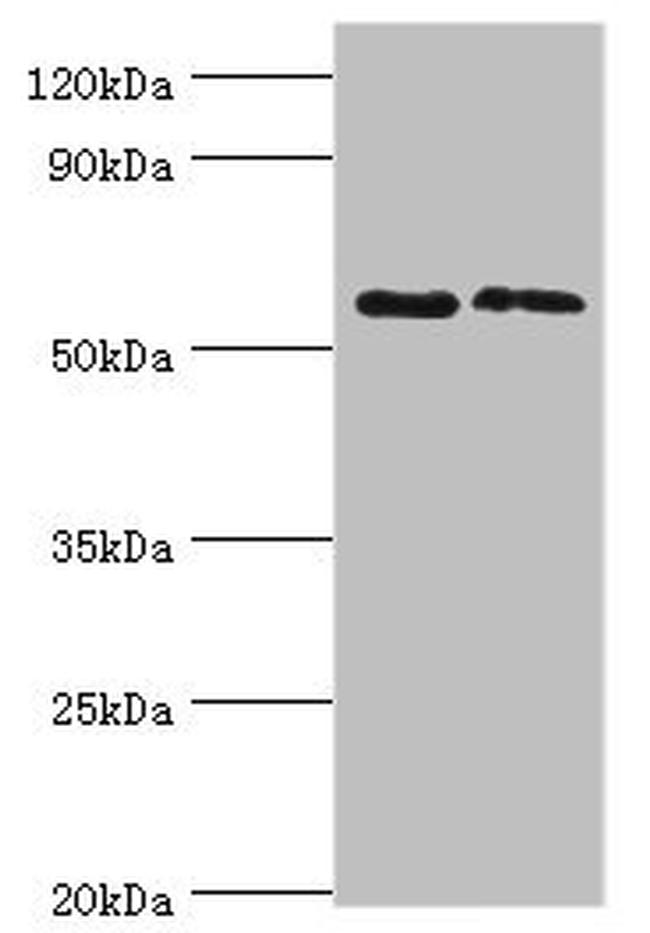 Placental Alkaline Phosphatase Antibody in Western Blot (WB)