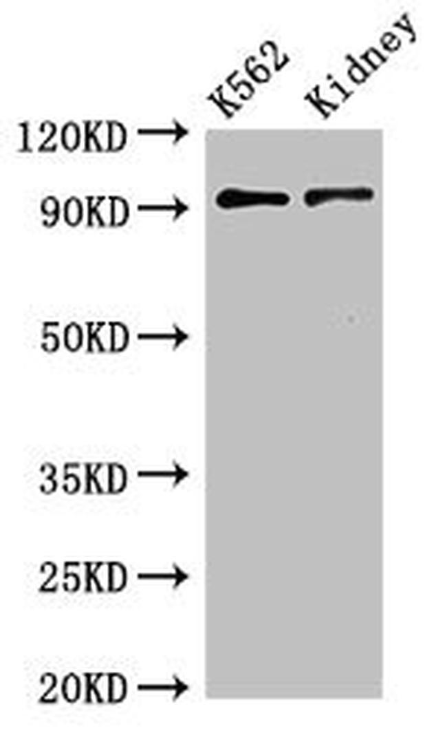 gamma Adaptin Antibody in Western Blot (WB)