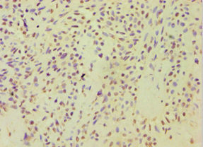 ARF3 Antibody in Immunohistochemistry (Paraffin) (IHC (P))