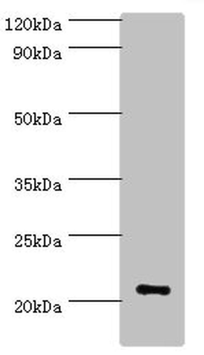 ARF3 Antibody in Western Blot (WB)