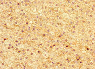 Asporin Antibody in Immunohistochemistry (Paraffin) (IHC (P))