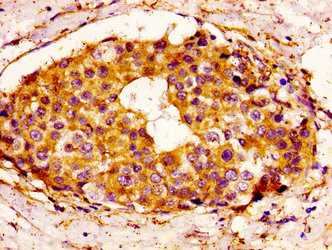 BCL-3 Antibody in Immunohistochemistry (Paraffin) (IHC (P))