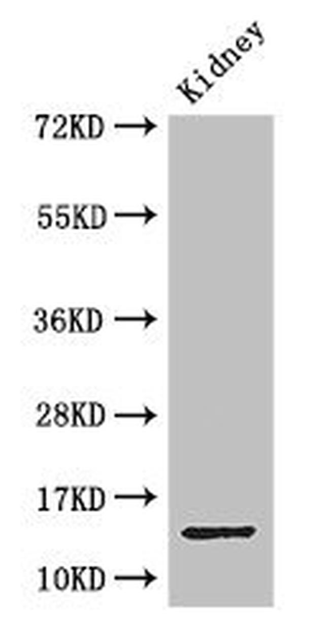 BRP44 Antibody in Western Blot (WB)