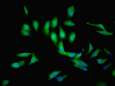 C1GALT1C1 Antibody in Immunocytochemistry (ICC/IF)