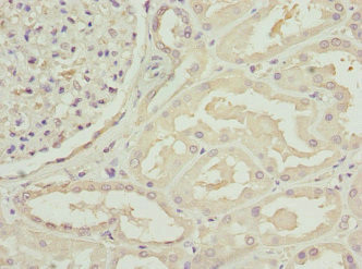 C1GALT1C1 Antibody in Immunohistochemistry (Paraffin) (IHC (P))