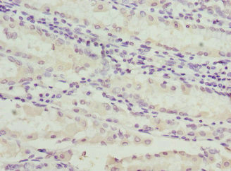 C1GALT1C1 Antibody in Immunohistochemistry (Paraffin) (IHC (P))