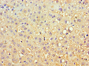 CBR3 Antibody in Immunohistochemistry (Paraffin) (IHC (P))