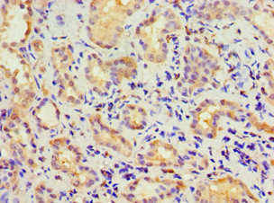 CBR3 Antibody in Immunohistochemistry (Paraffin) (IHC (P))