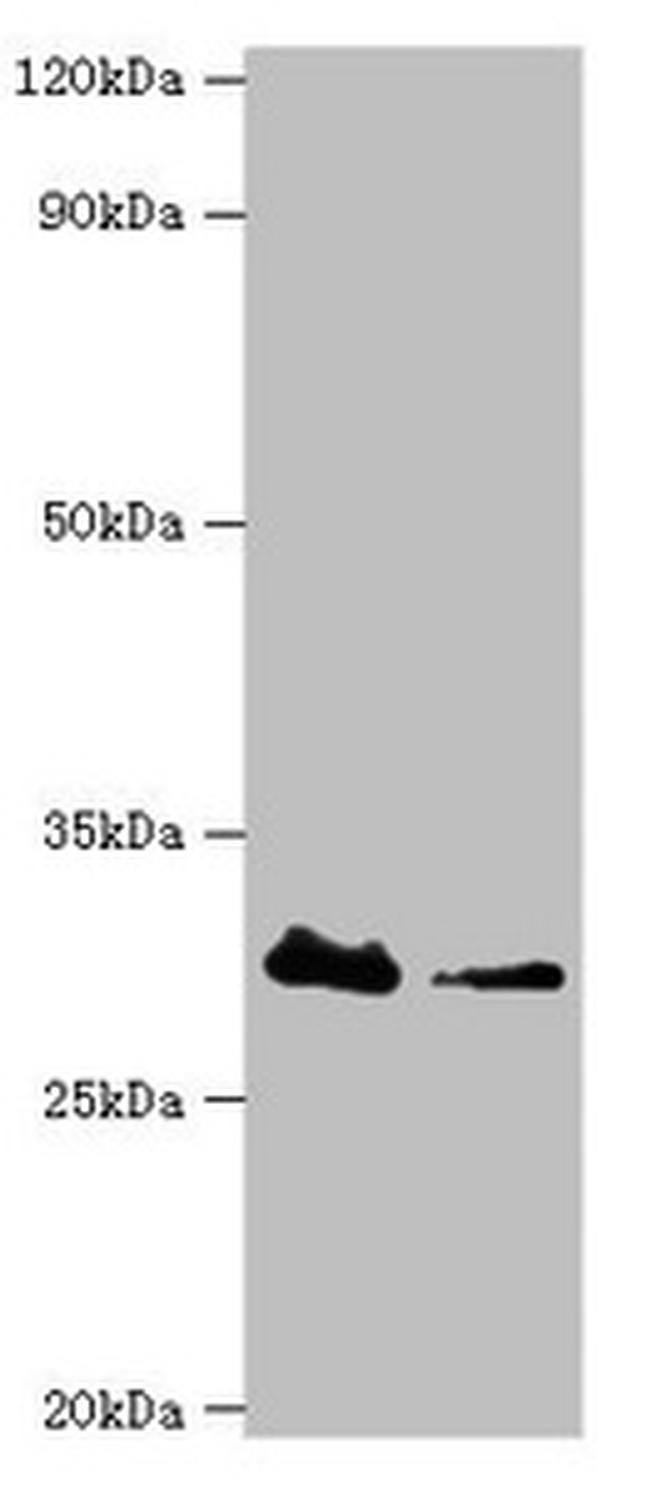 CBR3 Antibody in Western Blot (WB)