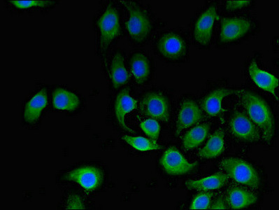 CD151 Antibody in Immunocytochemistry (ICC/IF)