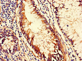 CD151 Antibody in Immunohistochemistry (Paraffin) (IHC (P))