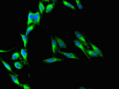 CD37 Antibody in Immunocytochemistry (ICC/IF)