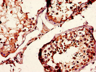 CD37 Antibody in Immunohistochemistry (Paraffin) (IHC (P))