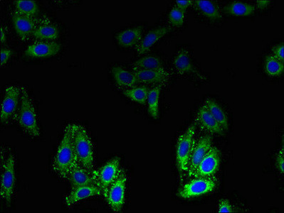 BLOC1S1 Antibody in Immunocytochemistry (ICC/IF)