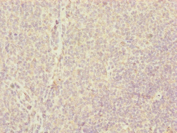 CENPH Antibody in Immunohistochemistry (Paraffin) (IHC (P))