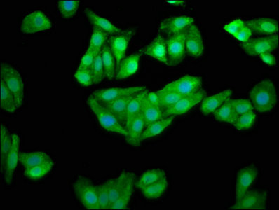 CHKB Antibody in Immunocytochemistry (ICC/IF)