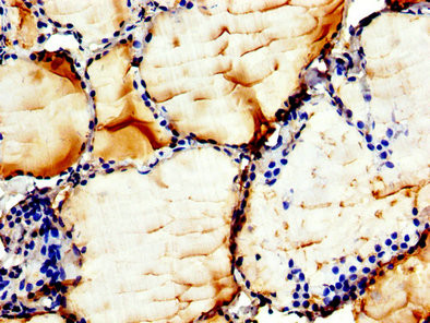 CHKB Antibody in Immunohistochemistry (Paraffin) (IHC (P))