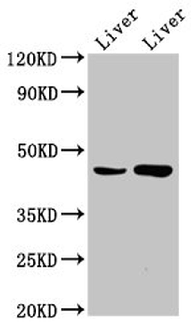 CHKB Antibody in Western Blot (WB)