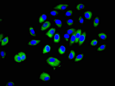 Crk Antibody in Immunocytochemistry (ICC/IF)