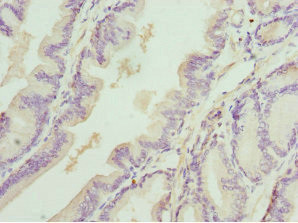 DEDD Antibody in Immunohistochemistry (Paraffin) (IHC (P))