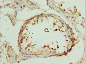 DEDD Antibody in Immunohistochemistry (Paraffin) (IHC (P))