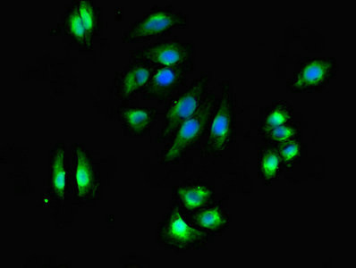 DHRS3 Antibody in Immunocytochemistry (ICC/IF)