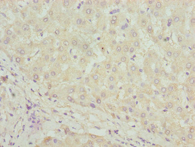 DHRS3 Antibody in Immunohistochemistry (Paraffin) (IHC (P))