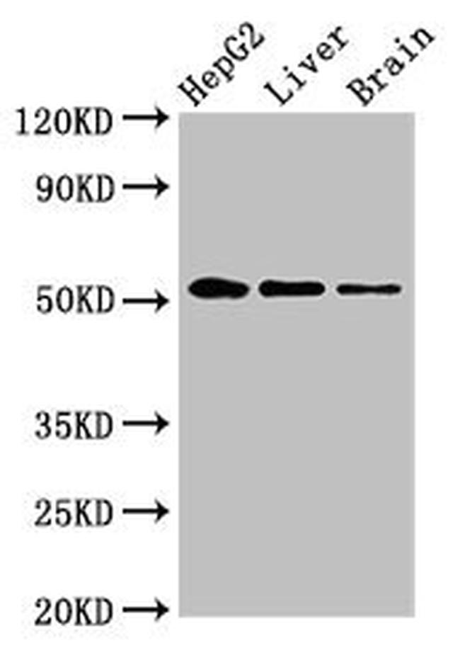 EGR2 Antibody in Western Blot (WB)