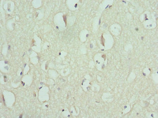 ENTPD2 Antibody in Immunohistochemistry (Paraffin) (IHC (P))