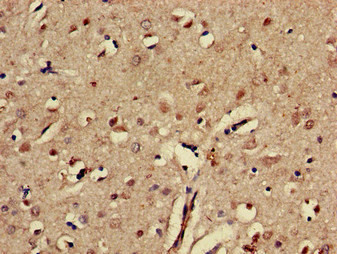 EphA5 Antibody in Immunohistochemistry (Paraffin) (IHC (P))