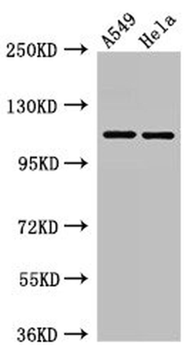 EphA5 Antibody in Western Blot (WB)