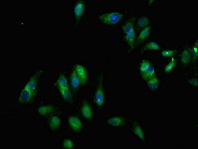 EphB3 Antibody in Immunocytochemistry (ICC/IF)