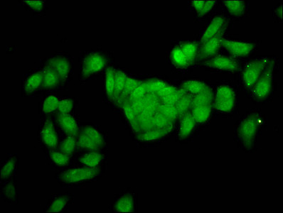 FBP2 Antibody in Immunocytochemistry (ICC/IF)