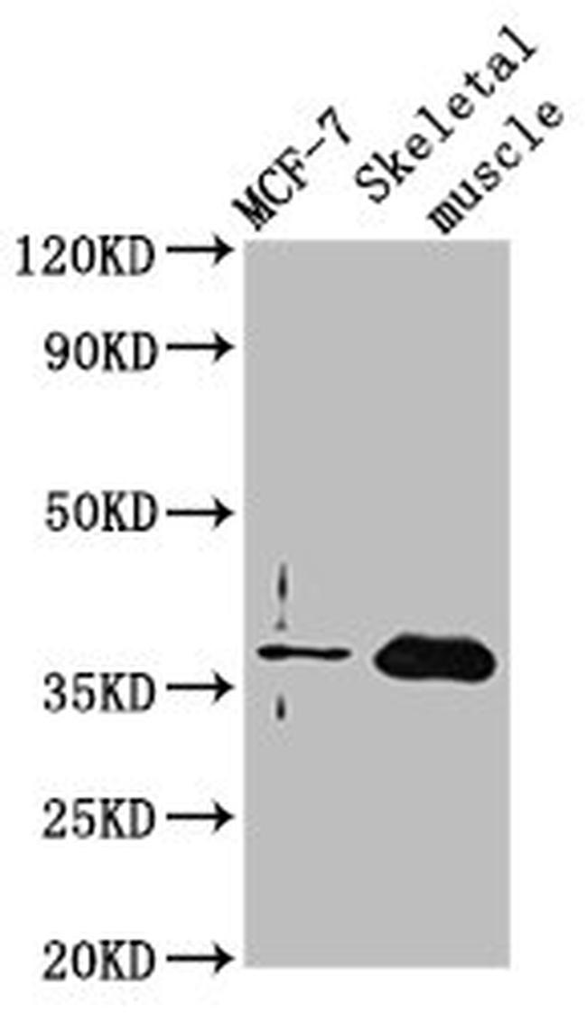 FBP2 Antibody in Western Blot (WB)