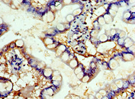 SHFM3 Antibody in Immunohistochemistry (Paraffin) (IHC (P))