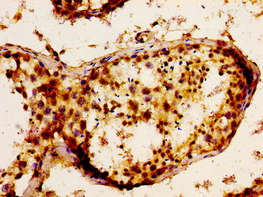 FGF17 Antibody in Immunohistochemistry (Paraffin) (IHC (P))