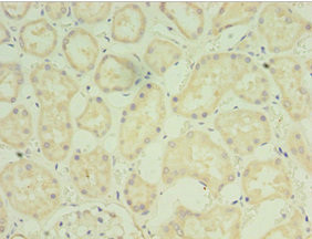 FGF6 Antibody in Immunohistochemistry (Paraffin) (IHC (P))