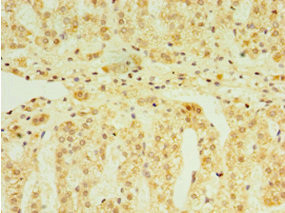 FGF6 Antibody in Immunohistochemistry (Paraffin) (IHC (P))