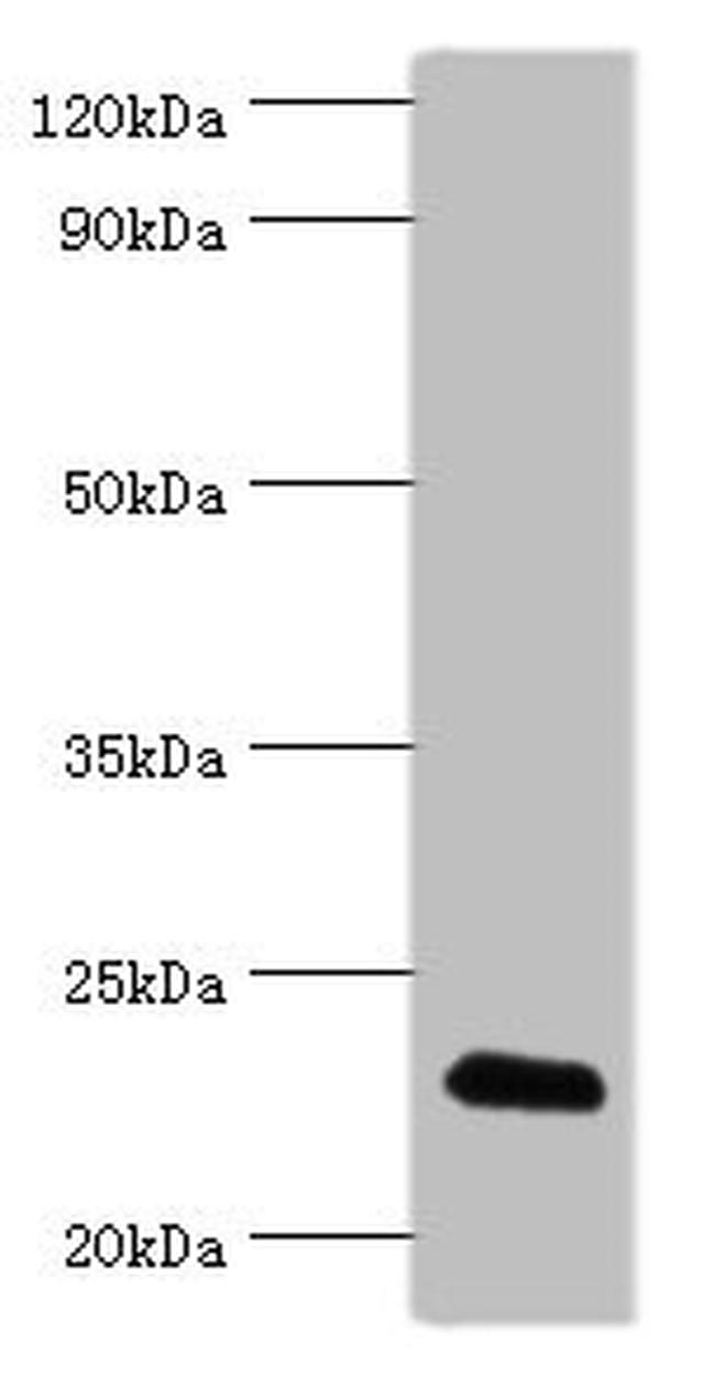 FGF6 Antibody in Western Blot (WB)