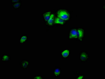 ILK Antibody in Immunocytochemistry (ICC/IF)