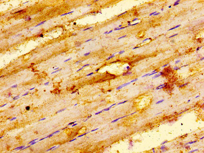 ILK Antibody in Immunohistochemistry (Paraffin) (IHC (P))