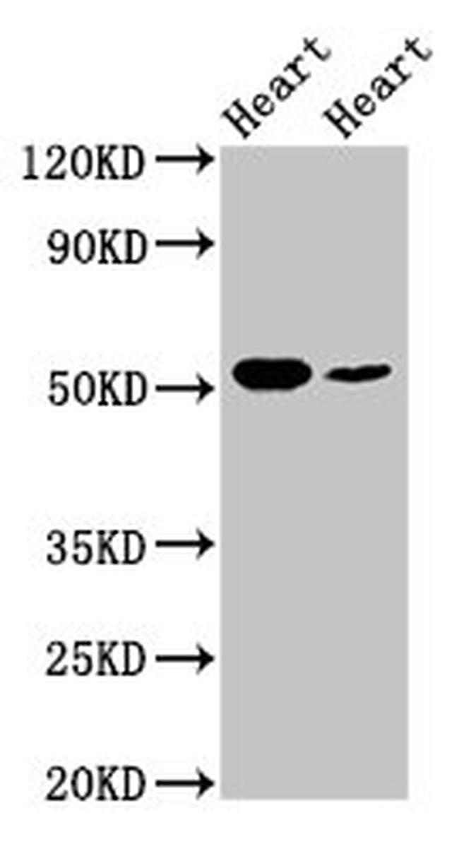 ILK Antibody in Western Blot (WB)