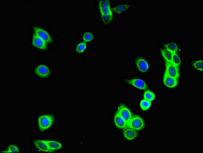 GUCY2C Antibody in Immunocytochemistry (ICC/IF)