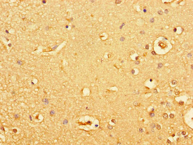 GUCY2C Antibody in Immunohistochemistry (Paraffin) (IHC (P))