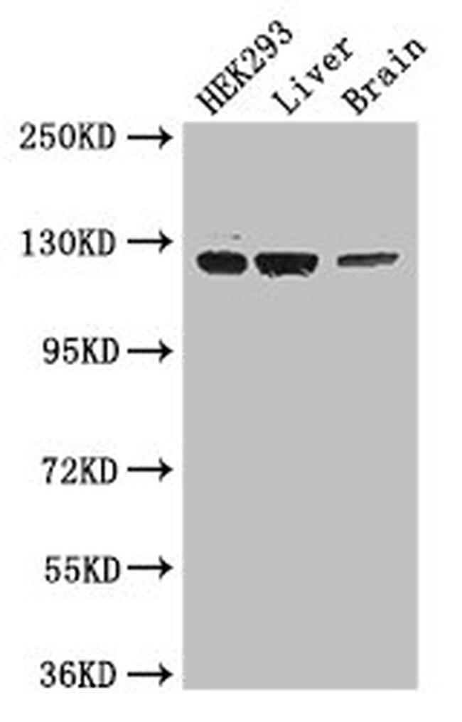 GUCY2C Antibody in Western Blot (WB)