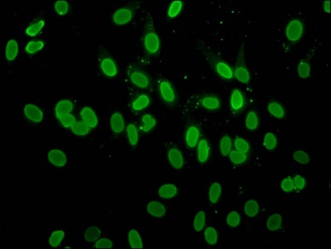 H2A.ZK4ac Antibody in Immunocytochemistry (ICC/IF)