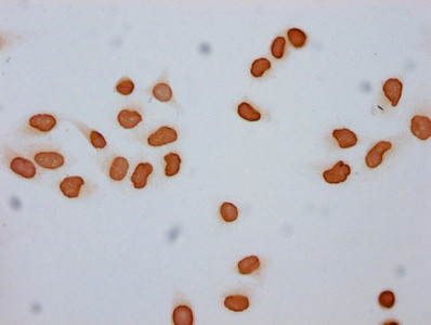 H2A.ZK7ac Antibody in Immunocytochemistry (ICC/IF)