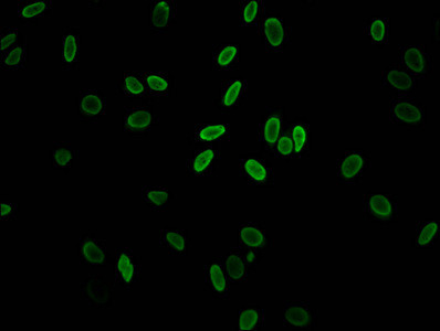 H2A.ZK11ac Antibody in Immunocytochemistry (ICC/IF)